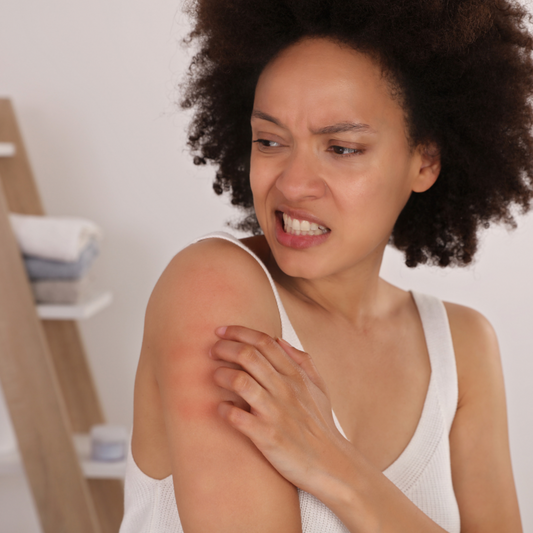 Eczema: Some things you should know